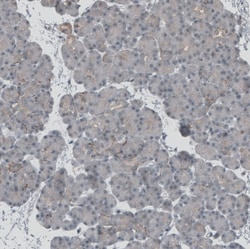 SKAP Antibody, Novus Biologicals:Antibodies:Primary Antibodies